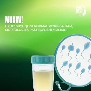 sperma muhim
