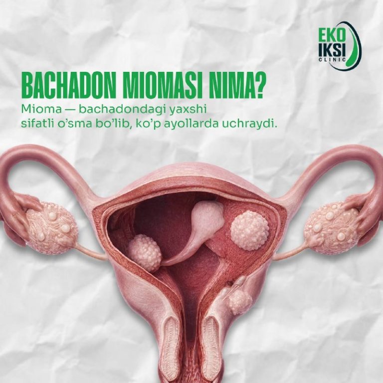 Bachadon miomasi haqida nimalarni bilish kerak?