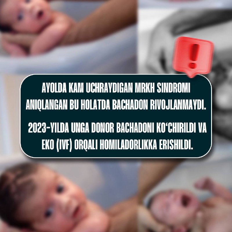Bachadon transplantatsiyasidan keyin farzand tug‘ilishi — reproduktiv tibbiyotdagi muhim yutuq.