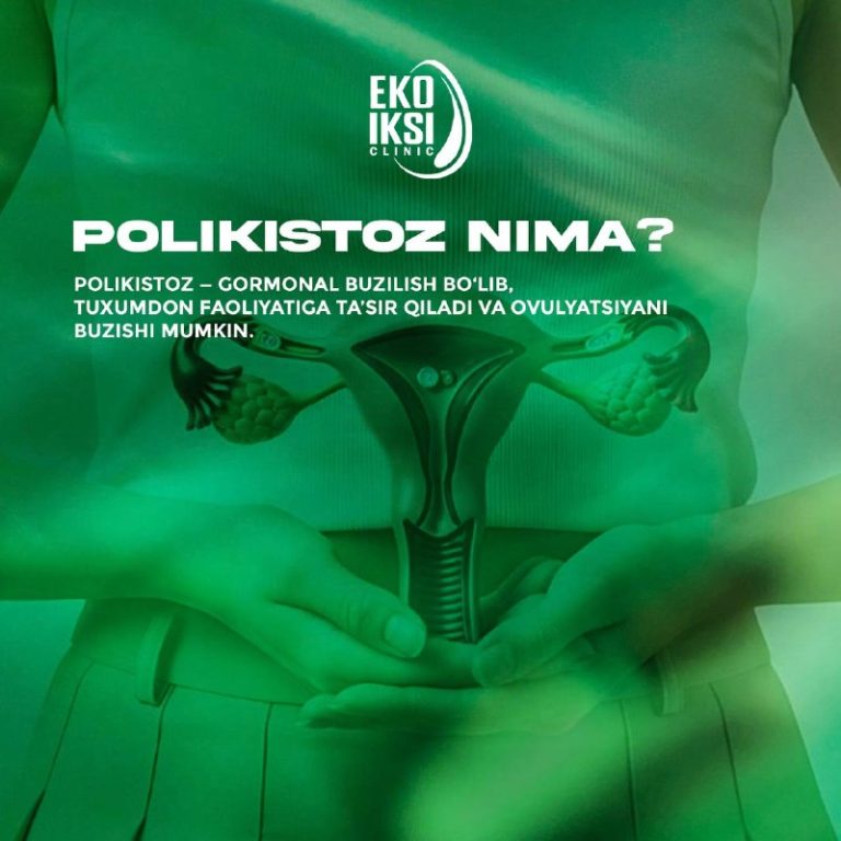 POLIKISTOZ NIMA?